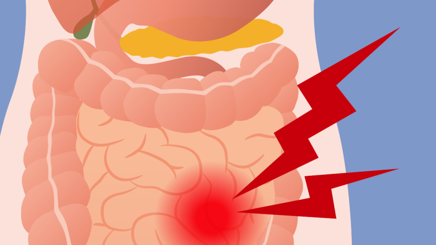 I studien såg forskarna att patienter med IBS har ökad genomsläpplighet för bakterier i modellsystemet. Foto: Shutterstock